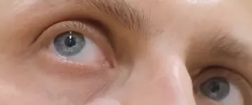 Adiós a las ojeras